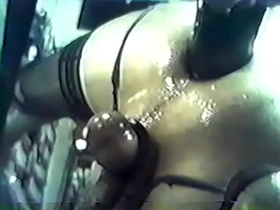 Extreme anal stretching