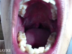 Opening the mouth very wide until the uvula