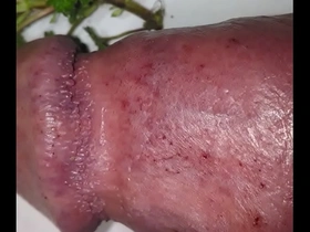 First nettles 2021 for my bruised cock