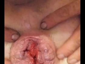 Me pushing out my toy and vibrator stretching my a******* and prolapsing