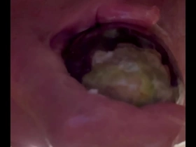 Fucking with 10in wide eggplant with rosebud prolapse