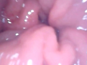 Inside my anal pussy view
